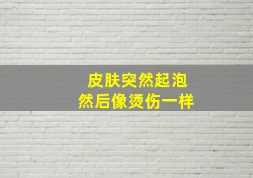 皮肤突然起泡然后像烫伤一样