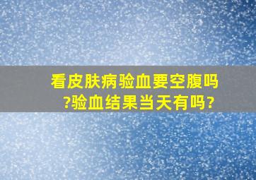 看皮肤病验血要空腹吗?验血结果当天有吗?