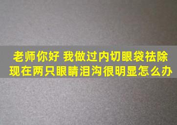 老师你好 我做过内切眼袋祛除 现在两只眼睛泪沟很明显怎么办