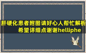 肝硬化患者附图,请好心人帮忙解析。希望详细点。谢谢……