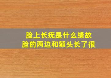 脸上长疣是什么缘故,脸的两边和额头长了很