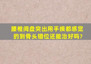 腰椎间盘突出,用手摸都感觉的到骨头错位,还能治好吗?