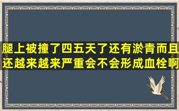 腿上被撞了四五天了还有淤青而且还越来越来严重会不会形成血栓啊