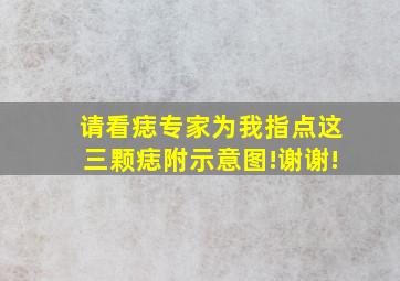 请看痣专家为我指点这三颗痣(附示意图)!谢谢!