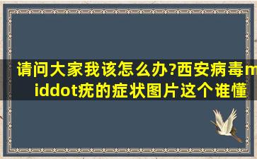 请问大家我该怎么办?西安病毒·疣的症状图片这个谁懂?