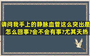 请问我手上的静脉血管这么突出,是怎么回事?会不会有事?尤其天热的...