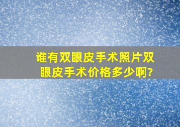 谁有双眼皮手术照片,双眼皮手术价格多少啊?