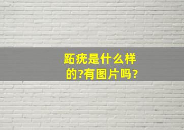 跖疣是什么样的?有图片吗?