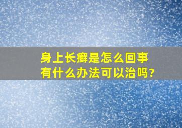 身上长癣是怎么回事 有什么办法可以治吗?