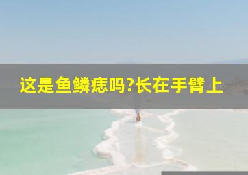 这是鱼鳞痣吗?长在手臂上