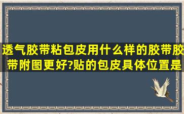 透气胶带粘包皮用什么样的胶带(胶带附图更好)?贴的包皮具体位置是哪...