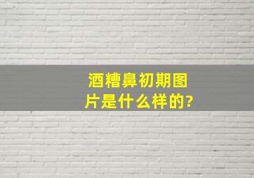 酒糟鼻初期图片是什么样的?