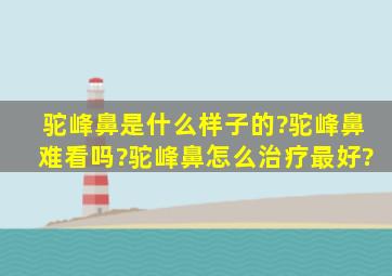 驼峰鼻是什么样子的?驼峰鼻难看吗?驼峰鼻怎么治疗最好?