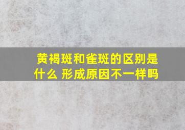 黄褐斑和雀斑的区别是什么 形成原因不一样吗