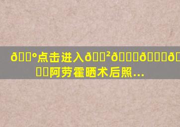 💰点击进入🎲𝟚𝕜𝕪.𝕋𝕆ℙ✅阿劳霍晒术后照...